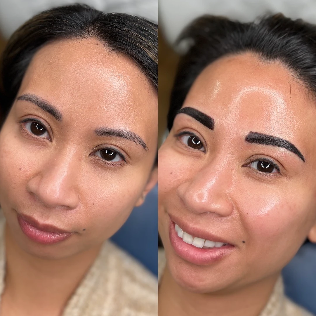 A before and after picture of the same woman 's eyebrows.