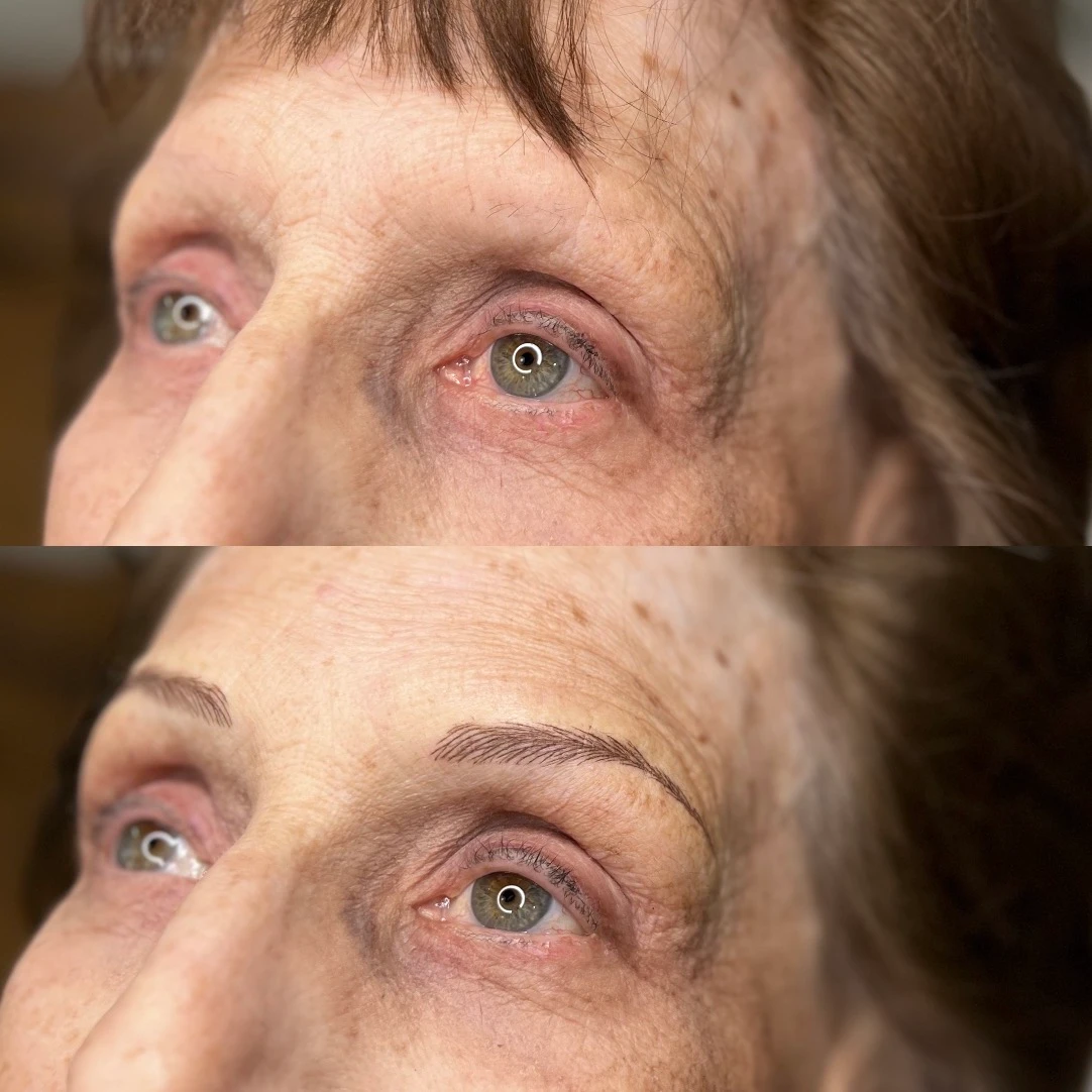 A before and after picture of the brows of an older woman.