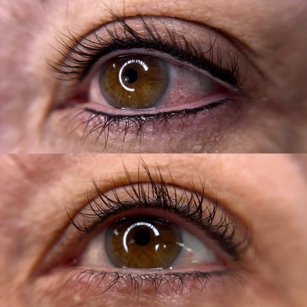 A before and after picture of the eyes of a woman.