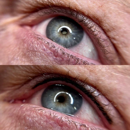 A before and after picture of the same eye.
