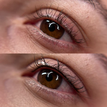 A woman 's eyes before and after using the same technique.