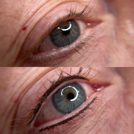 A before and after picture of the same eye area.