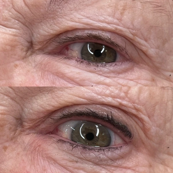 A before and after picture of an older woman 's eyes.