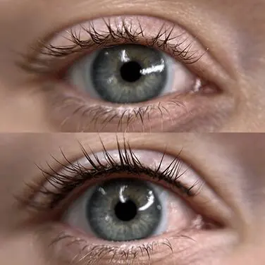 A before and after picture of the eyes of two people.