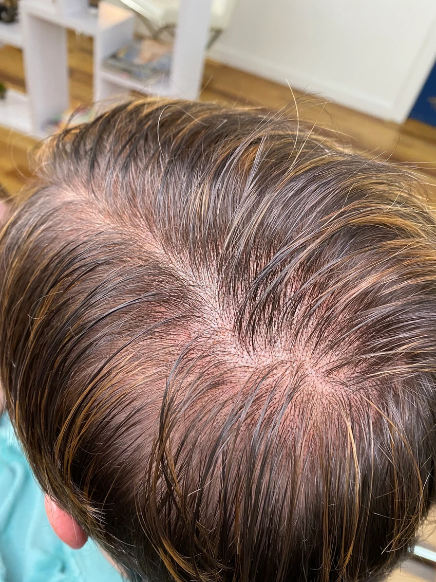 A close up of the top portion of a woman 's head