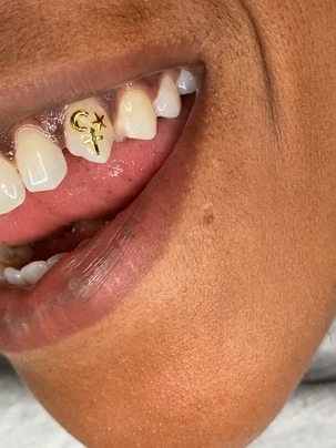 A woman with yellow and white teeth has an arrow on her mouth.