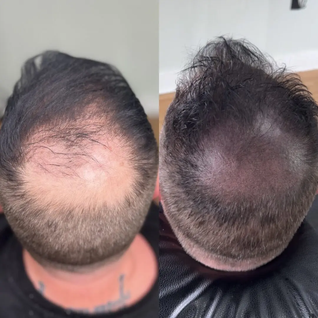 A before and after photo of a man 's hair.